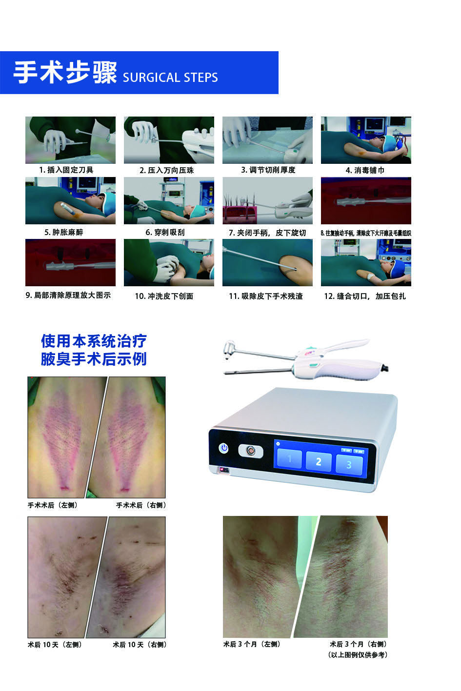 腋臭旋切系统3.jpg